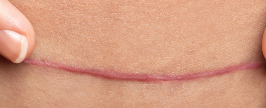 For Health Care Practitioners